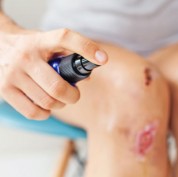 beneficios-agua-oxigenada